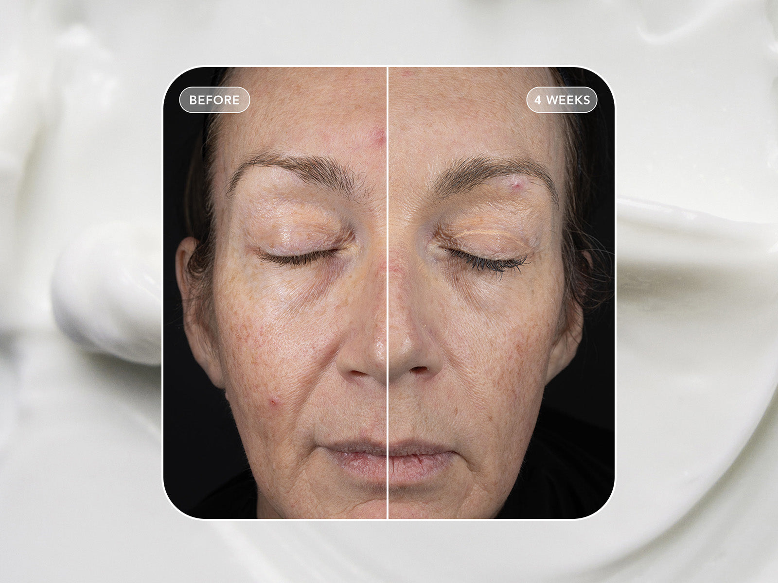 VOL.U.LIFT - 4D Skin Rebound Complex