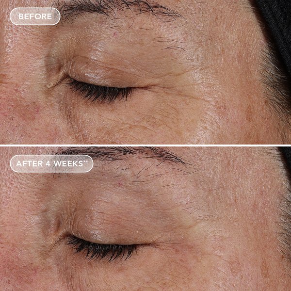 PURE LIQUID RETINOL 0.1% 